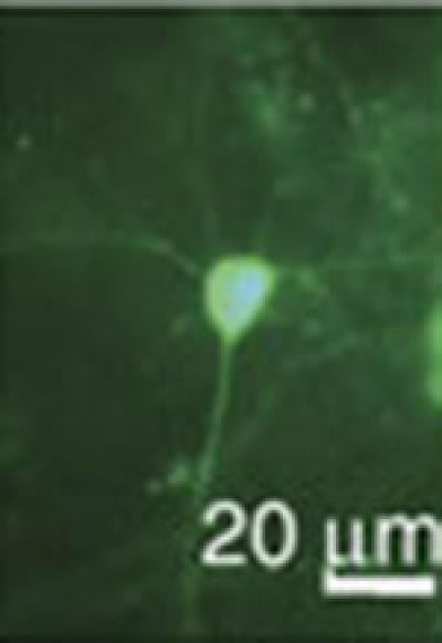 Mouse Neuron