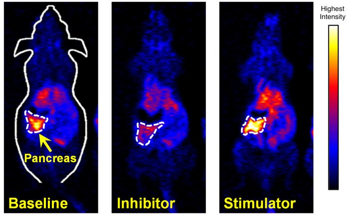 PET Scans