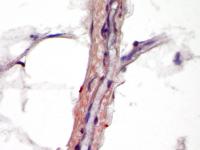 WISP-1