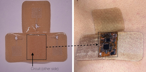 wireless ECG device (larger)