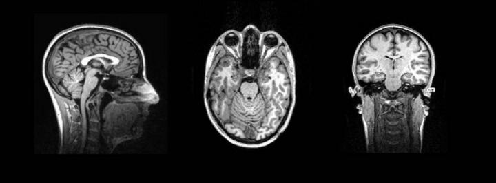 Further Standard Brain Image
