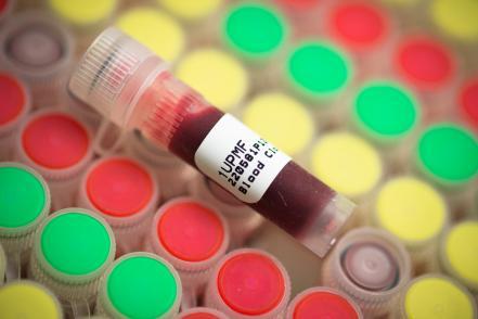 MSU Biobank Vials