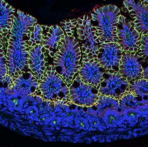 Neonatal intestine