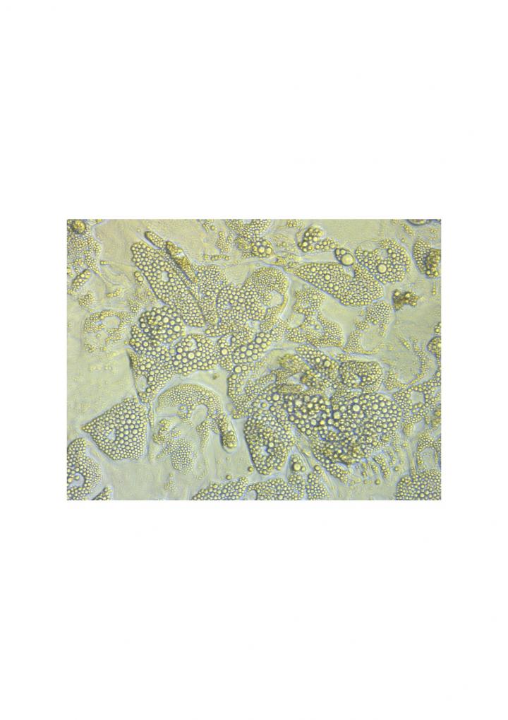 Brown Fat Cells
