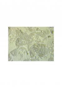 Brown Fat Cells