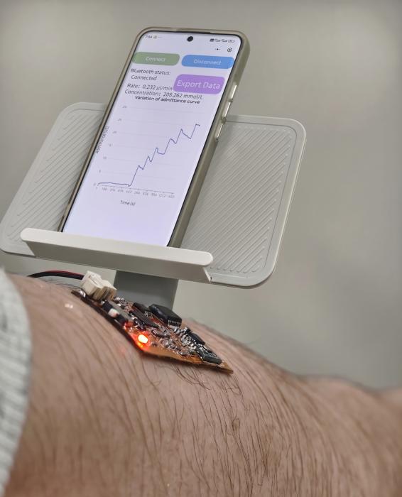A vertically integrated microfluidic sweat sensor
