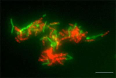 A Mixed Culture of a Methane Producer, RC-I Archaeon