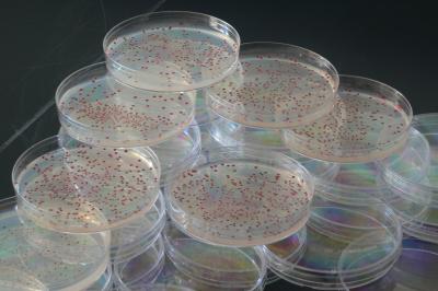 In Bacterial Evolution, the Tortoise Trumps the Hare (1 of 4)