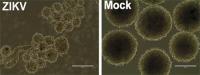 Zika Virus Neurospheres