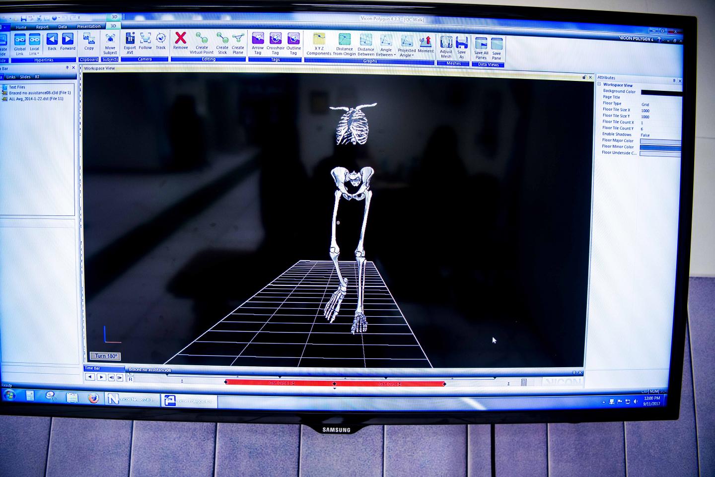 Motion Analysis at Children's Hospital Los Angeles