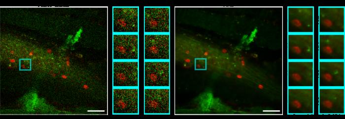 Denoising results for in vivo venule images in the cremaster muscles of mice.