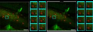 Denoising results for in vivo venule images in the cremaster muscles of mice.