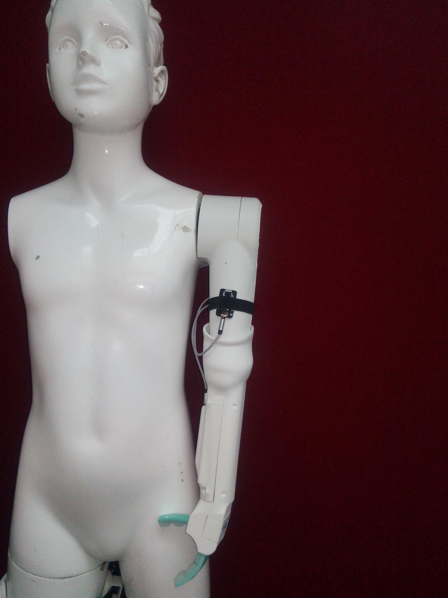 SIMPA Toddler Prosthetic Arm