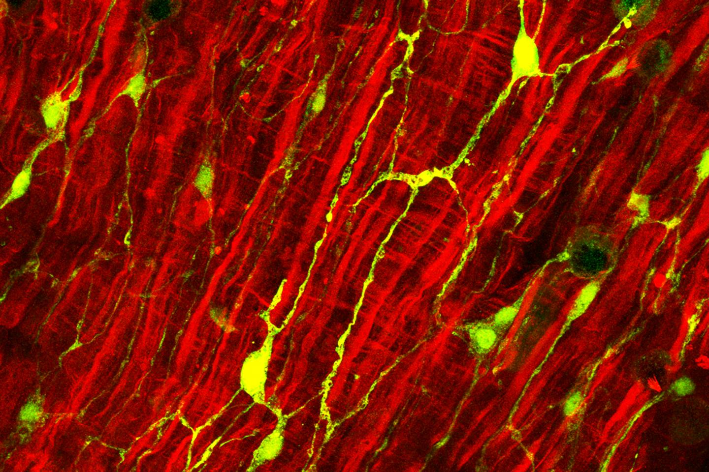 Hydra's Intestinal Tissue and Nerve Cells