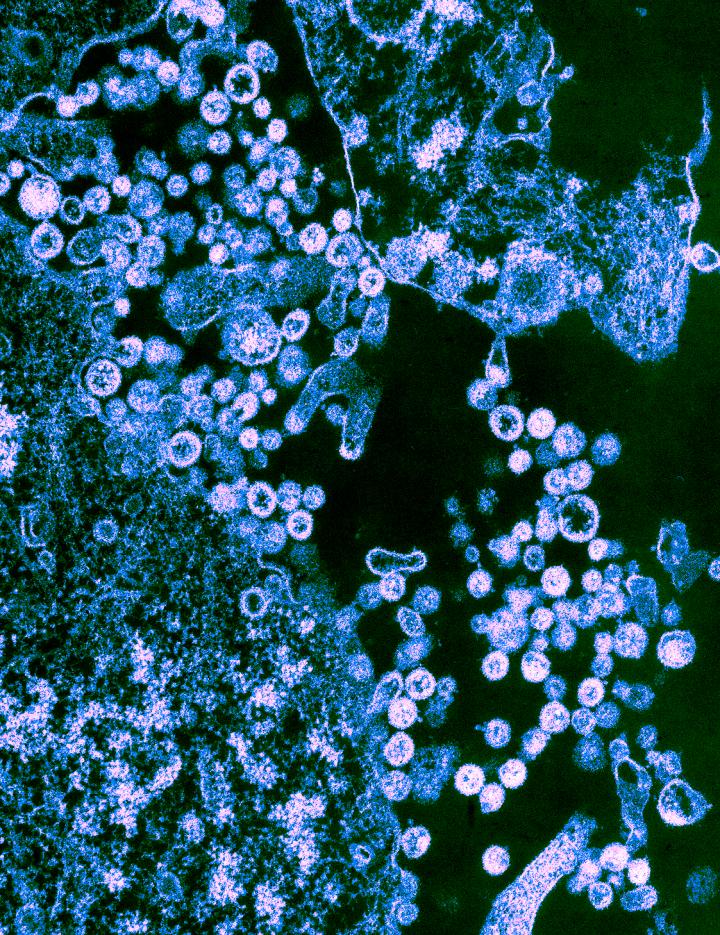 Lassa Virus Josiah Strain