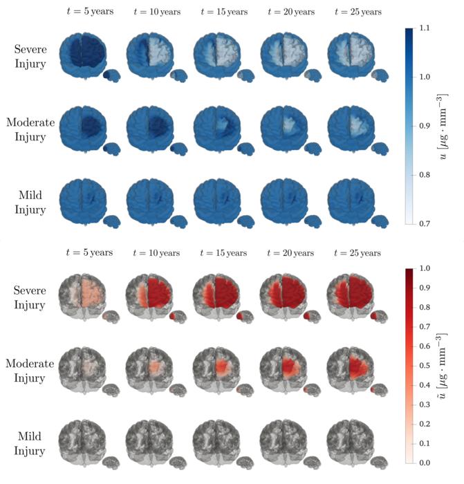 Amyloid Porous Brain