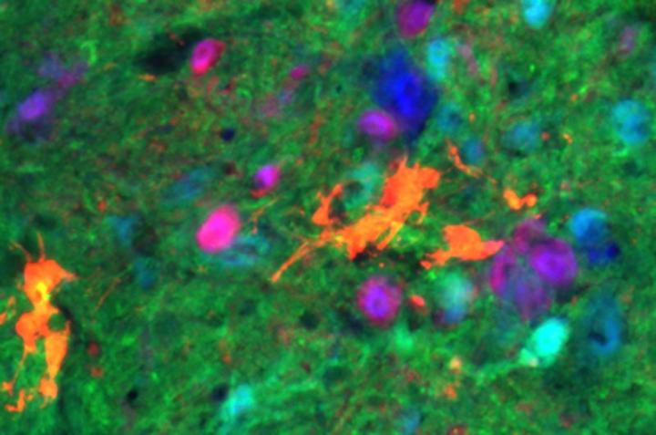 V2a Interneurons