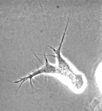 Prostate Cancer Cell