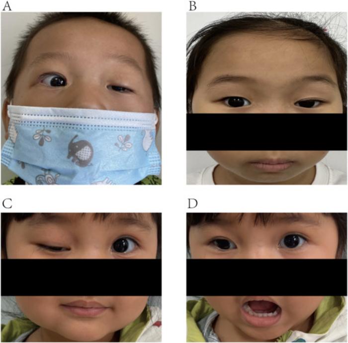 The photographs of visual habitual behaviors in MGJWS and BP patients