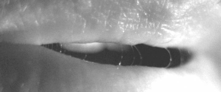 How Speech Propels Pathogens