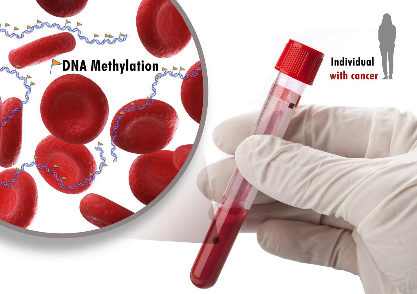 Common Signature Found in Tumor DNA 5 Types of Cancer
