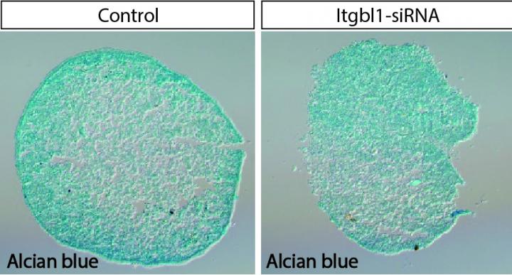 Cell Receptor Signaling Gone Awry Underlies Joint Degeneration in Arthritis (1 of 2)