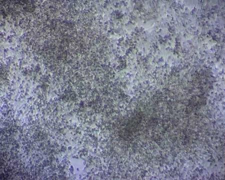 Beating Cardiomyocytes 