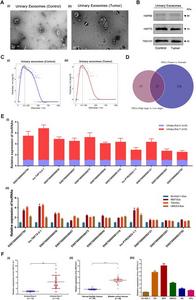 Extraction, identification, high-throughput lncRNA chip sequencing, and differentially expressed lncRNA selection of urinary exosomes isolated from bladder cancer (BCa) patients.