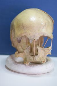 Pe&#351;tera Muierii 1 skull
