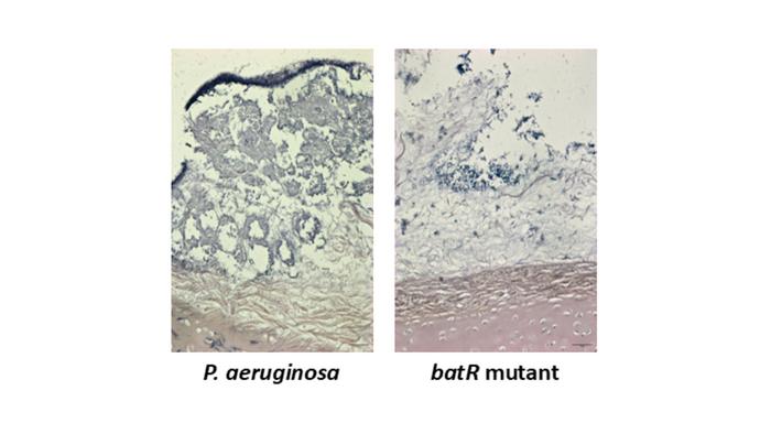 Biofilm clue opens route to anti-infection treatments