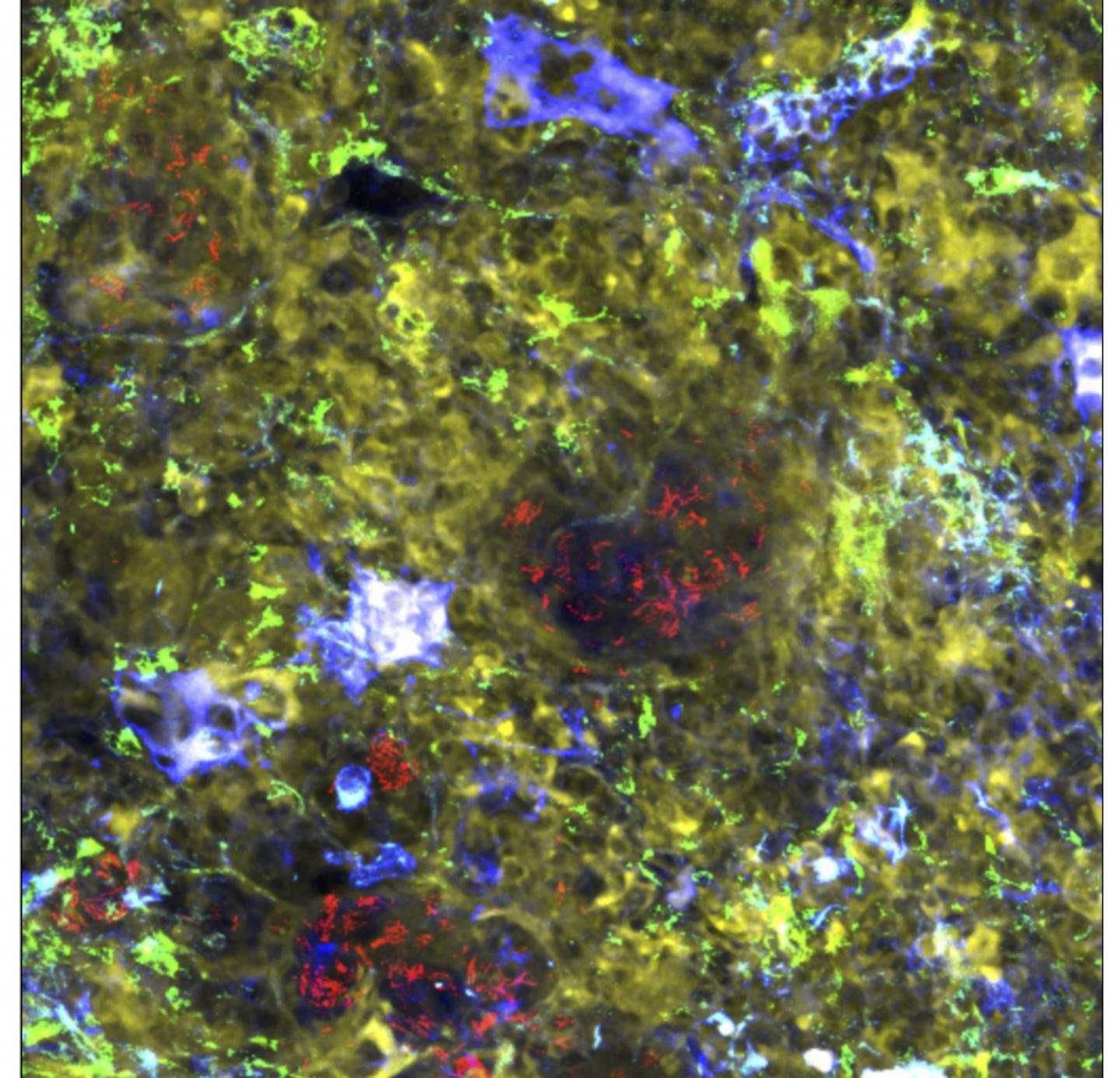Repurposed Medications Enhance Tuberculosis Treatment in Mice
