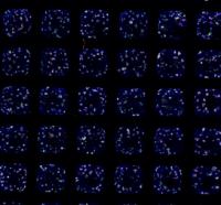 Kidney Organoids Generated By Robots