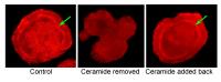 Lipid Plays Big Role in Embryonic Development