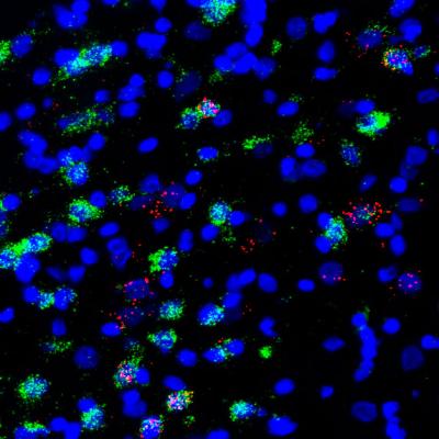 Neurons in NTS