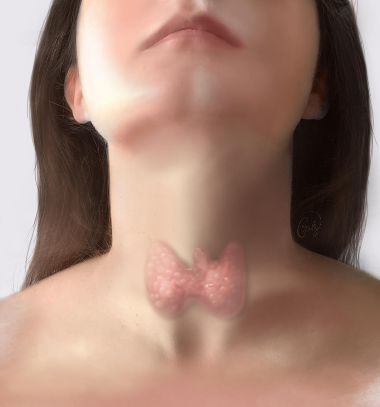 Thyroid