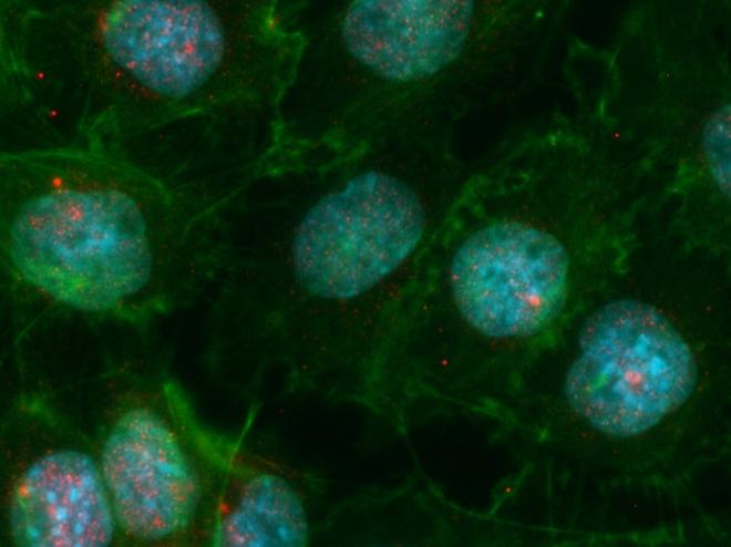 Medullary Thymic Epithelial Cells (mTECs)