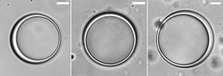 Protein-RNA vesicles (differential interference contrast microscopy)