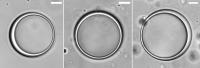 Protein-RNA vesicles (differential interference contrast microscopy)