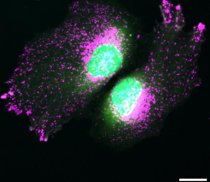 Distribution of lysosomes in cells lacking TBC1D9B.