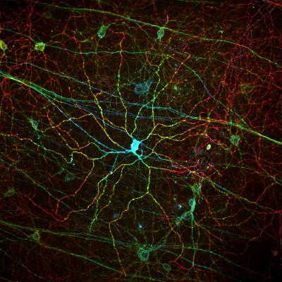 Melanopsin Looks on the Bright Side of Life (2 of 2)