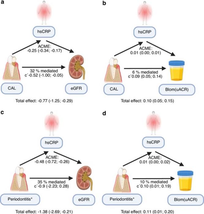 Periodontitis and kidney function in early chronic kidney disease