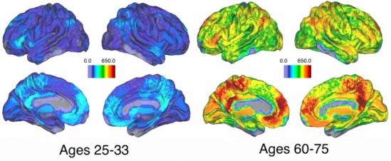 Brains