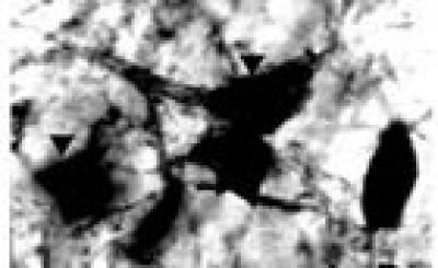 Tyrosine