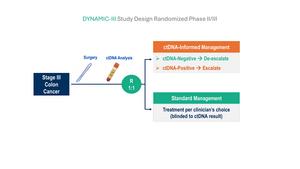 ctDNA-guided approach to adjuvant chemotherapy in stage 3 colon cancer