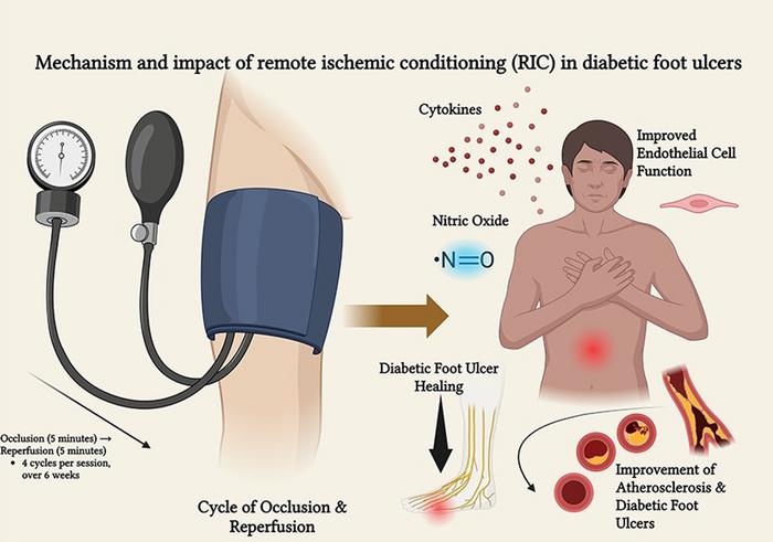 Mechanism of remote ischemic conditioning (RIC) in diabetic wound repair.