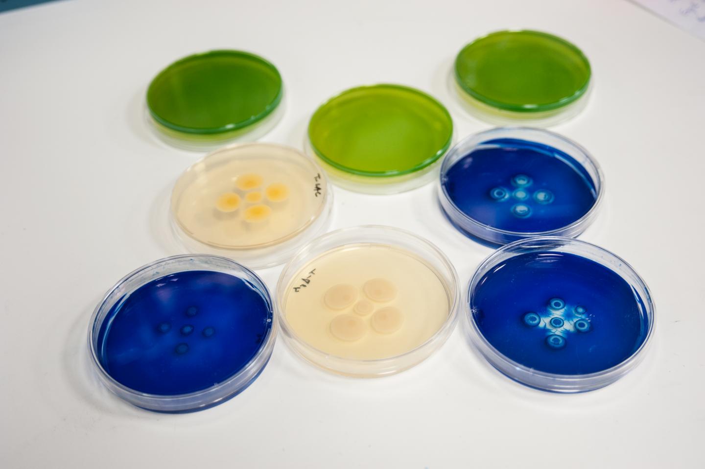 Superbugs