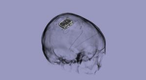 Picostim neurostimulator