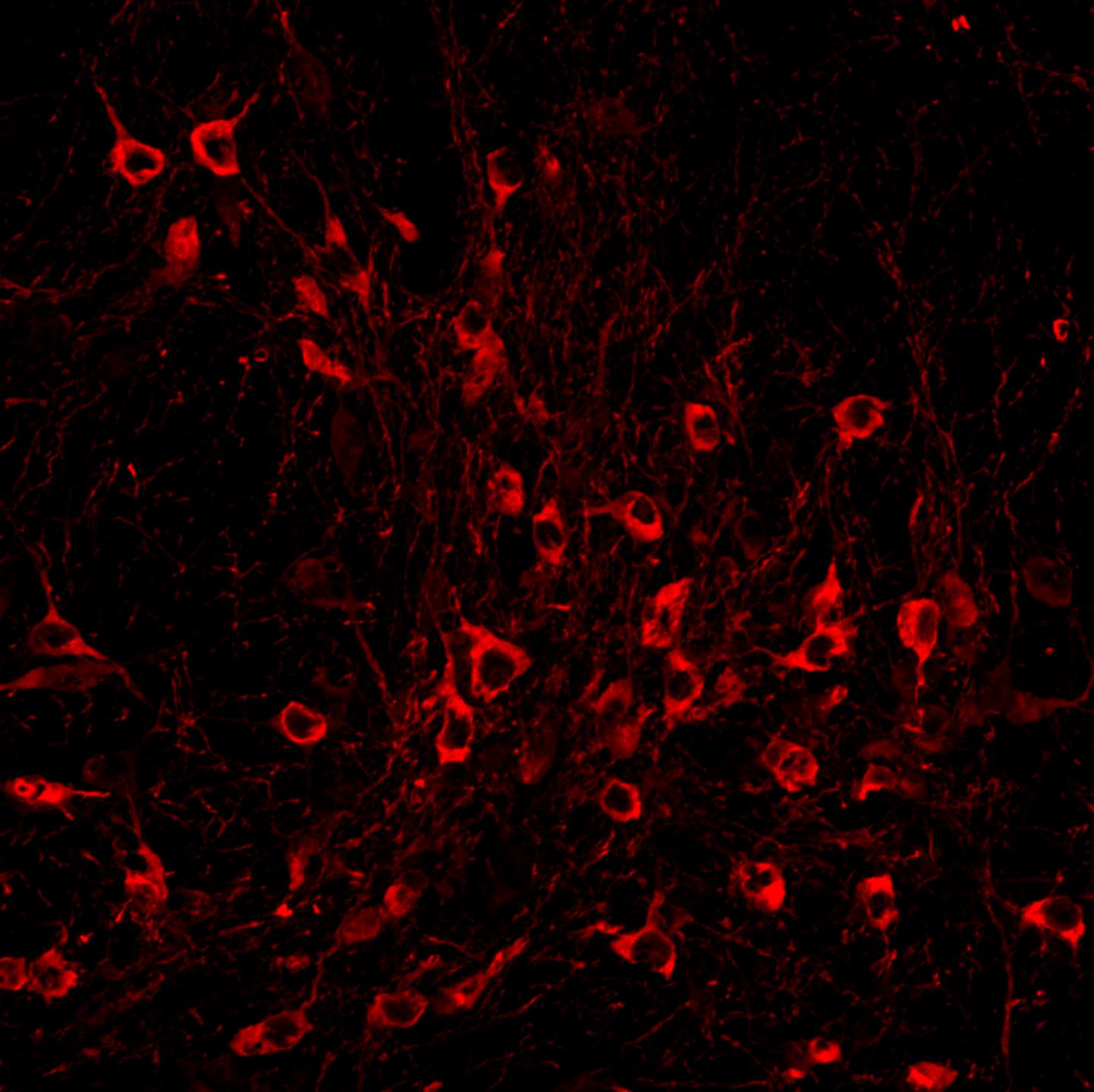 Dopamine neurons