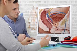 Application of artificial intelligence (AI) in prostate cancer (PCa)