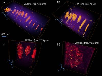 X‑ray Tomography